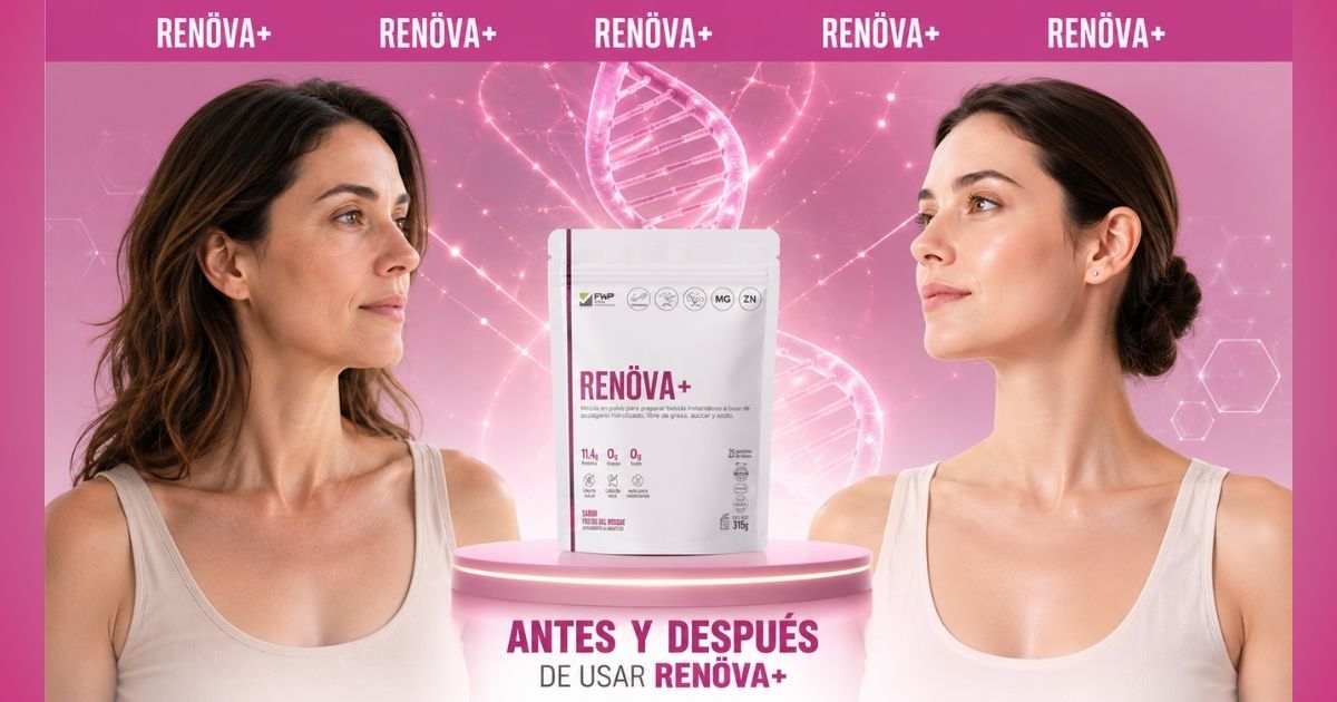 Antes y Después RENÖVA+